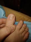 Полоска на ногте большого пальца ноги фото 5