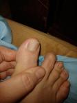 Полоска на ногте большого пальца ноги фото 4