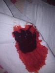 Месячные со сгустками крови фото 2