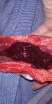 Месячные со сгустками крови фото 1