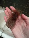 Резкое выпадение волос и т. д. Цинк, медь фото 3