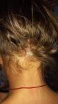 Болячка на волосистой части головы у ребенка фото 1