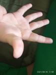Подушечки пальцев рук фото 1