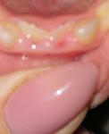Рост зубов у ребенка фото 1