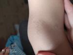 Непонятные высыпания на ножке у ребенка 2 года фото 2