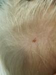 Коричневое пятнышко на голове у ребёнка 2 лет фото 1