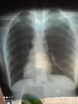 Снимок лёгких и грудного отдела фото 2