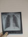Рентген органов грудной клетки фото 1