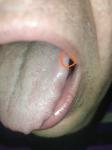 Белое пятно на языке после травмы фото 1