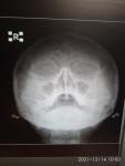 Рентгеновский снимок фото 1