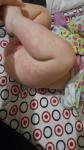 Пятна на теле у ребенка грудничка фото 1