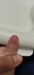 Пятно на ногте руки фото 3