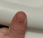 Пятно на ногте руки фото 2