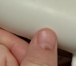 Пятно на ногте руки фото 1