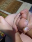 У 1.6 сына большой пальчик на ноге шелушится и кожа трескается фото 3
