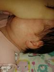 Акне новорожденных или аллергия фото 1