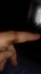 Опух палец сильно болит и дёргает фото 2