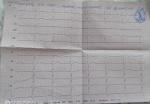 Помогите расшифровать кардиограмму сердца. Спасибо фото 2