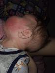 Зуд и мокнущая сыпь у ребёнка 6 месяцев фото 1