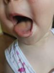 Желтый язык ребенка фото 1