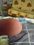 Маленькие белые точки на подушечке указательного пальца фото 2