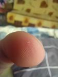 Маленькие белые точки на подушечке указательного пальца фото 3