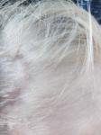 Зудящие сыпь на голове у ребёнка фото 3
