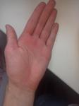 Почему у меня постоянно красные кисти рук? фото 1