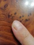 Как лечить грибок ногтей рук? фото 3