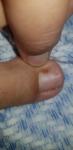 Что за пятно на ногте? фото 1