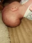 Вытянутая форма головы новорожденного фото 3