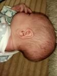 Вытянутая форма головы новорожденного фото 2
