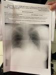Рентген лёгких, средостения фото 1