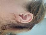 Зуд и боль в левом ухе фото 1