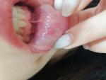 Слизистая полости рта. Слизистая нижней губы фото 2