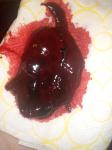 Сгусток крови, месячные фото 1