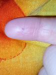 Красная точка на подушечки пальца фото 1