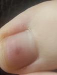 Симметричные точки на ногтях больших пальцев фото 2
