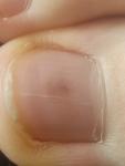 Симметричные точки на ногтях больших пальцев фото 1