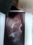 Расшифровка УЗИ, диагностика беременности фото 1