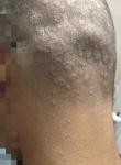 Кольцеобразное поражение волосистой части головы фото 2