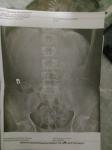 Описание рентгена, выявление патологий по снимку фото 1