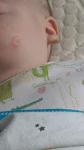 Красное пятнышко на щеке двухмесячного ребенка фото 1