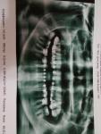 Корни зубов не в костной ткани фото 1