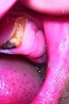 Корень зуба воспален фото 1