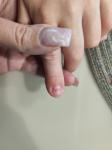 Опухла подушечка пальца у ребенка фото 5
