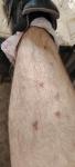 Болячки на голени ногах фото 1