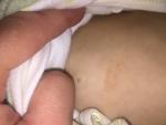 Светло-коричневое пятнышко на теле ребенка 10 месяцев фото 1