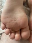 Странные ступни ног у ребенка фото 4