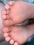 Странные ступни ног у ребенка фото 2